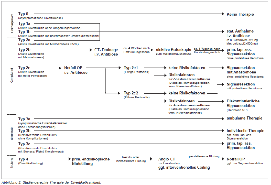 Divertikulitis stadiengerechte Therapie